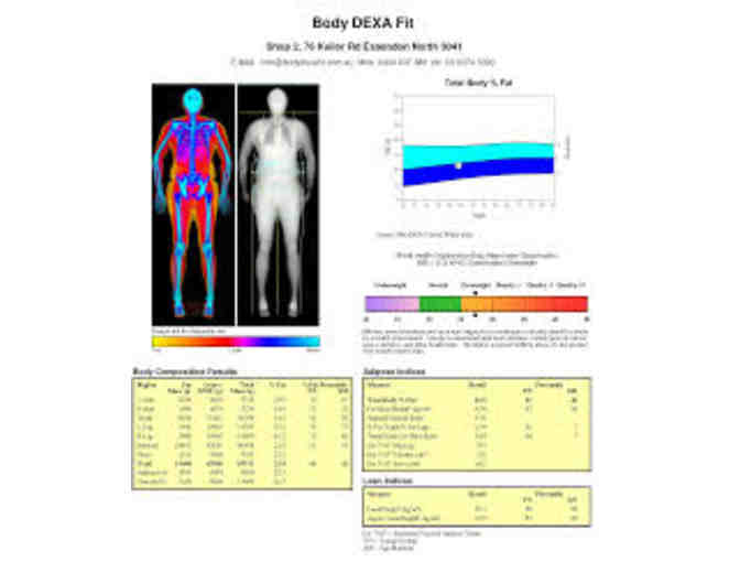 Free DEXA Body Composition Scan