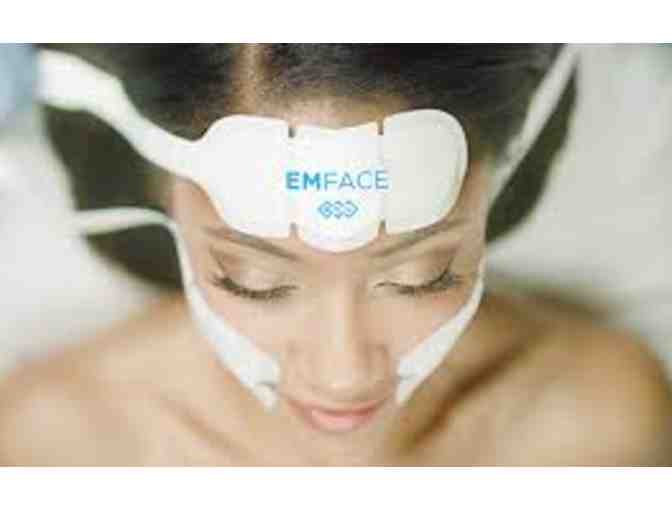 EMFACE Full Facial Treatment courtesy of Generations Dentistry