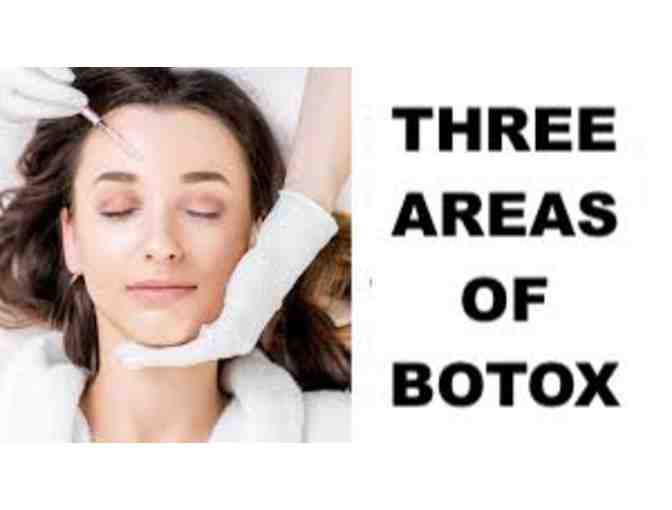 3 Areas of Botox (Brand Name Dysport) - Photo 1